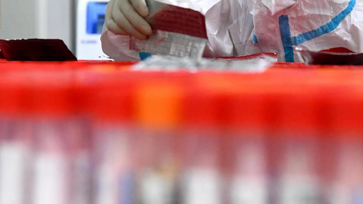 北京金准醫學檢驗實驗室核酸檢測涉違法犯罪被立案