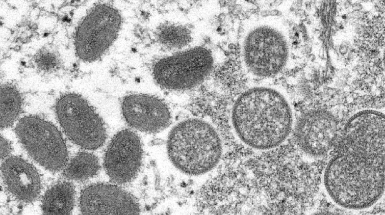 世衛組織：猴痘疫情暫不構成國際關注的突發公共衛生事件