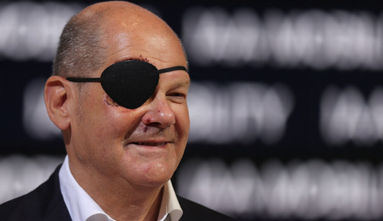 朔爾茨跑步時摔傷臉部 戴眼罩海盜形象引熱議