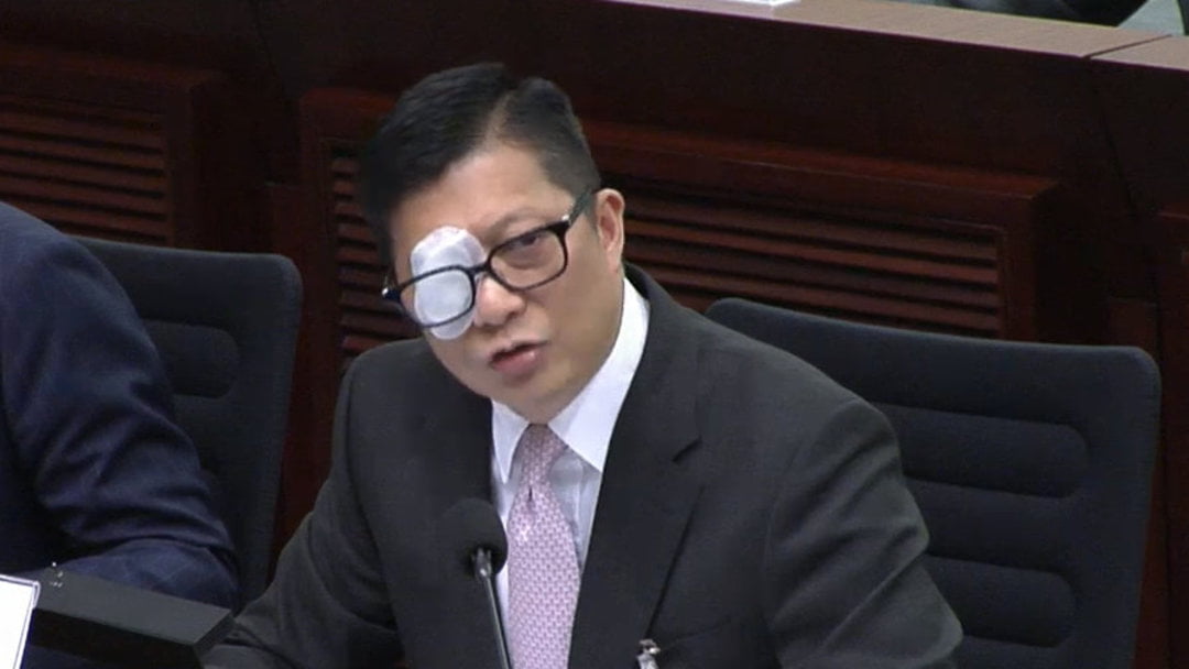 鄧炳強右眼受感染 包紗布出席立法會會議