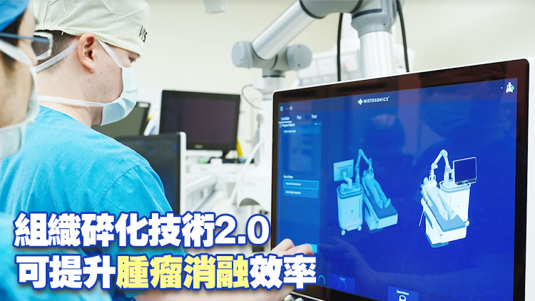 有片｜中大醫學院獲李嘉誠基金會捐贈Histotripsy 2.0系統 資助30患者接受新技術治療肝癌