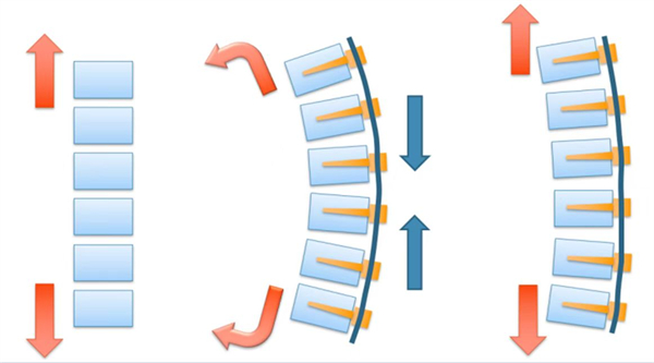 圖1： VBT技術原理圖，通過在側彎凸側置釘，使用人工韌帶彈性固定，隨着脊柱的生長，側彎會逐漸改善。.jpg